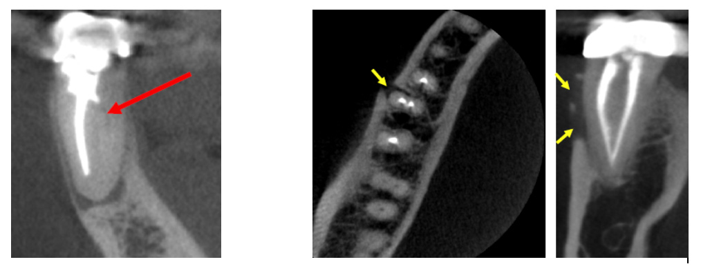 CBCT Technology in Abilene
